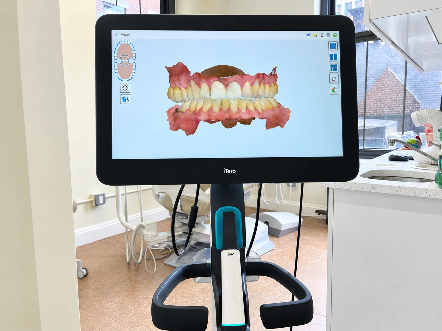 iTero intraoral scanner showing a 3D scan of a patient's bite