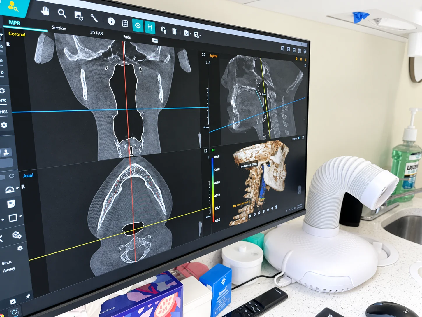Cone beam CT scan of the jaw and airway on the treatment room monitor